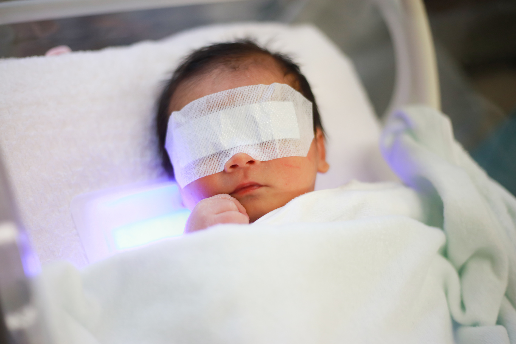 Phototherapy for neonatal jaundice