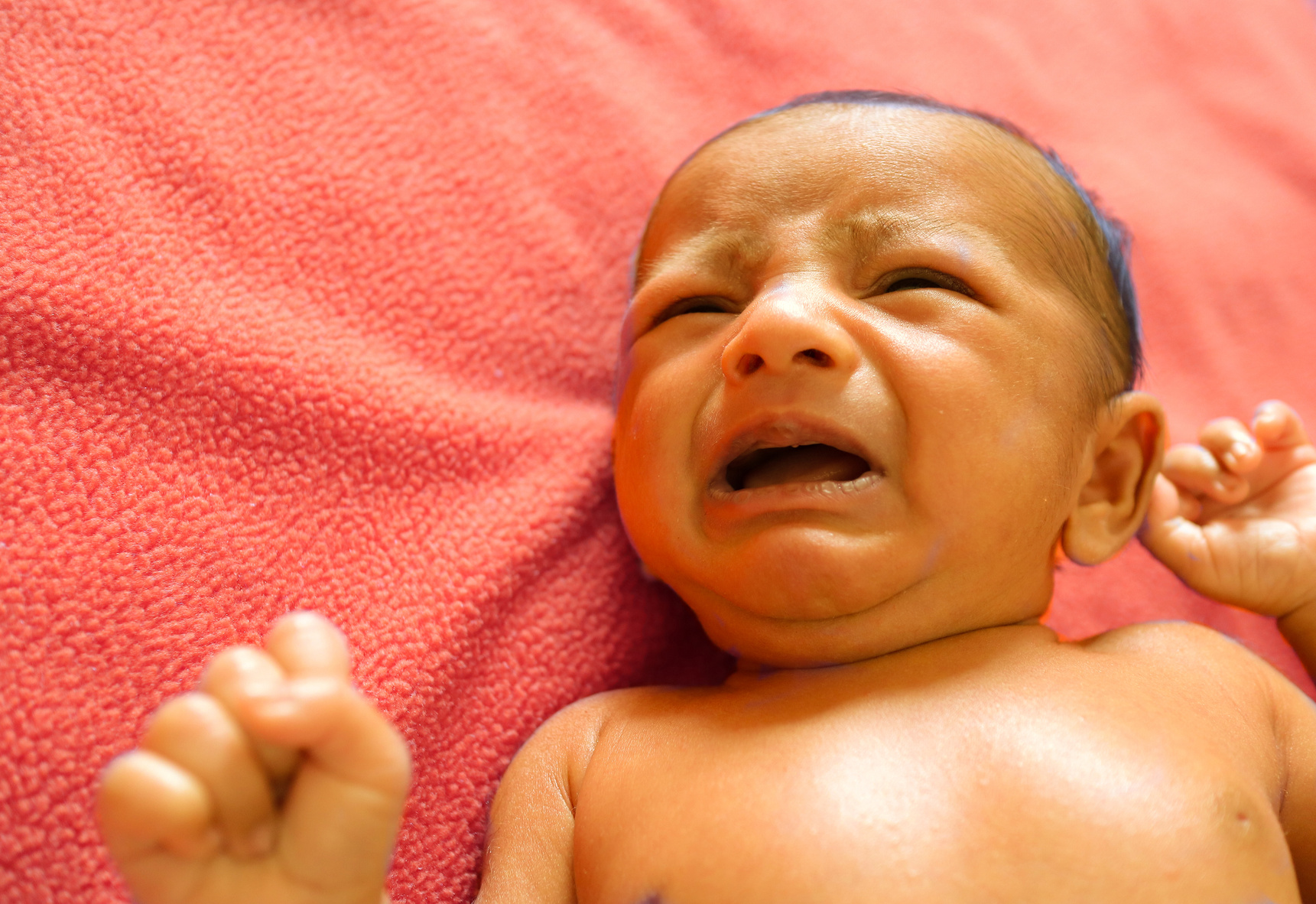 a yellow skin colored neonatal jaundice baby crying in pain.