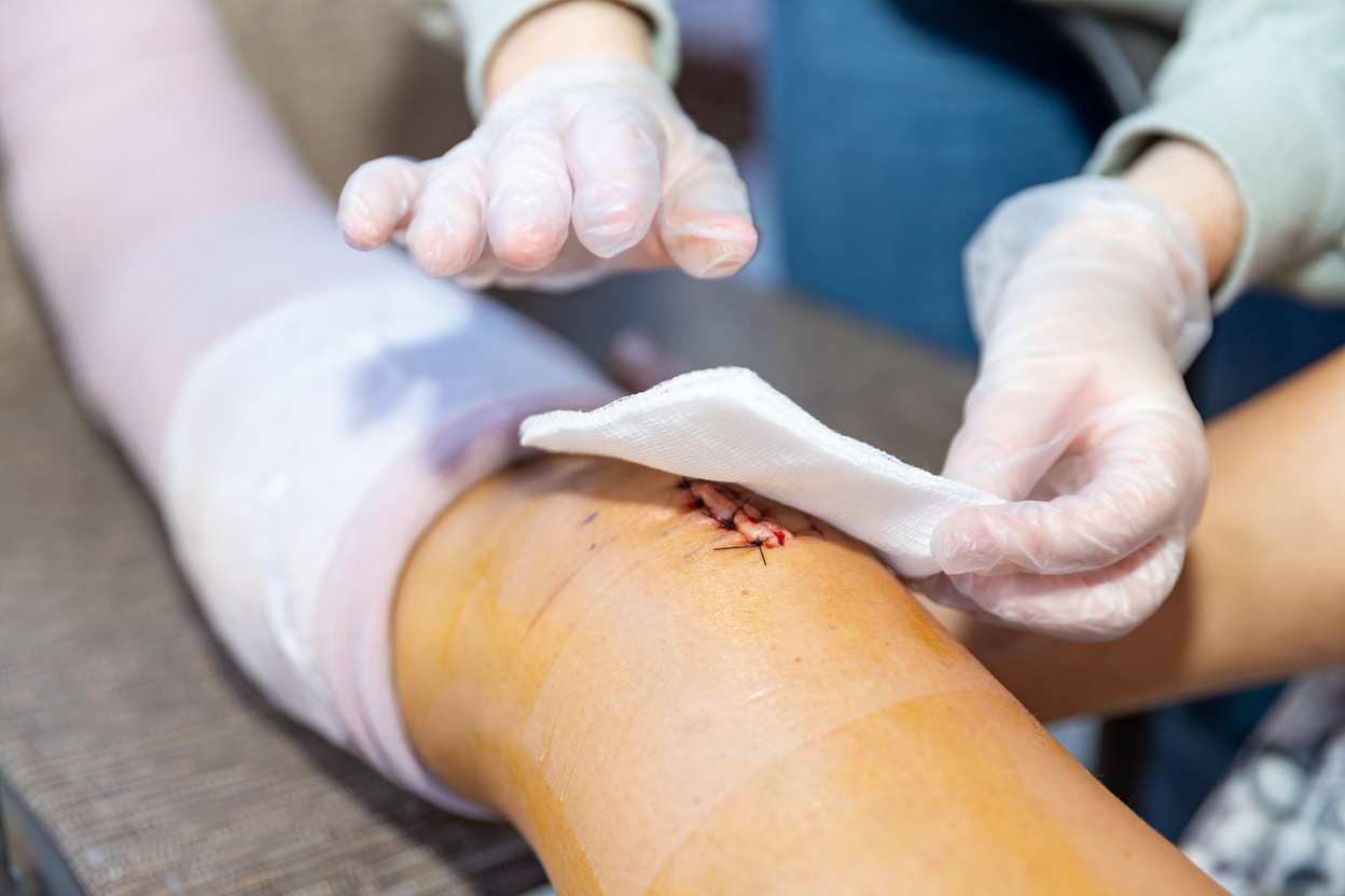 Cleaning and dressing wound after surgery