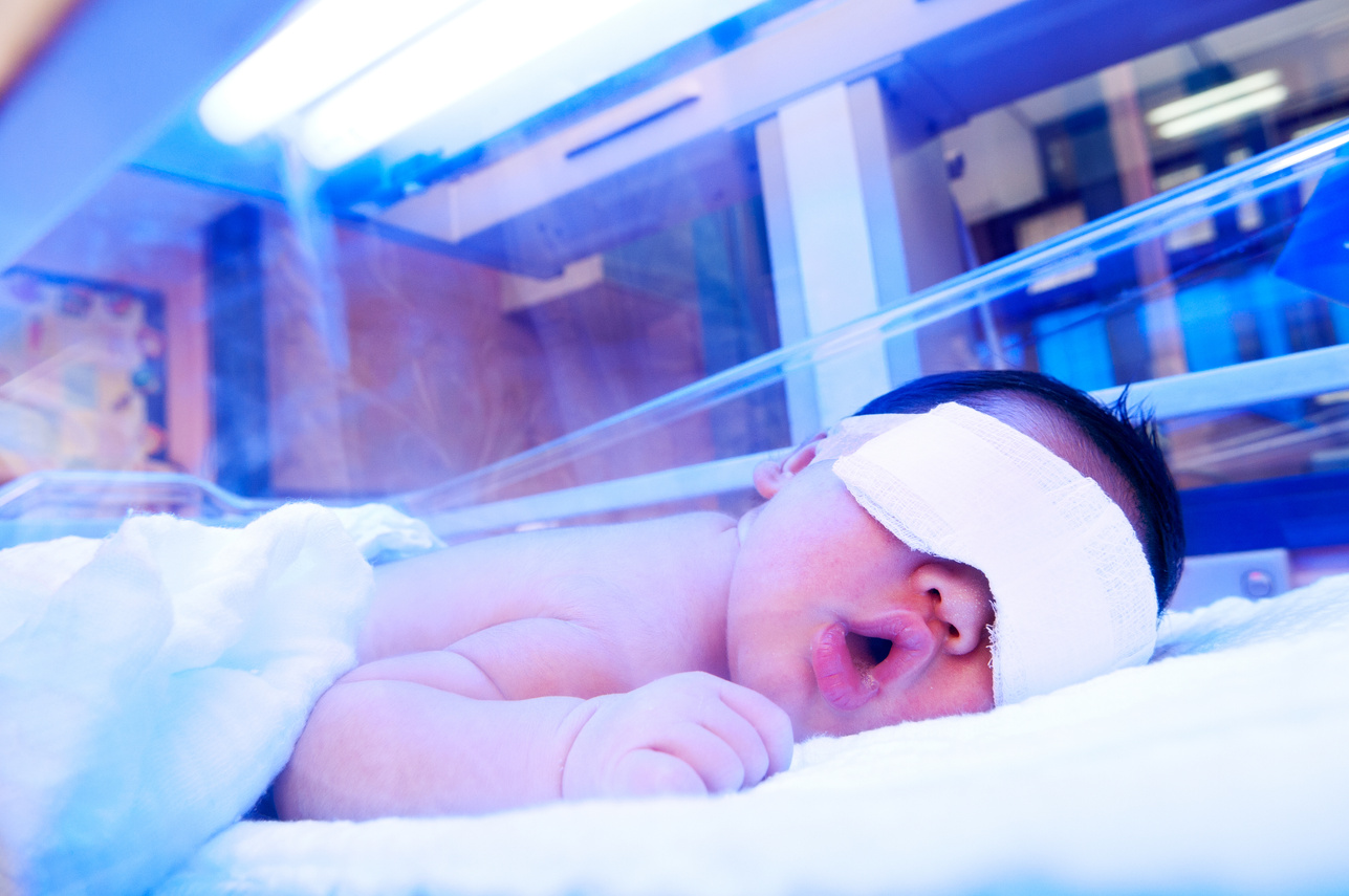 Newborn under Ultraviolet Light